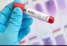 देश में फिर बढ़ने लगे स्वाइन फ्लू के मामले, दिल्ली समेत इन राज्यों के लोग रहें सावधान