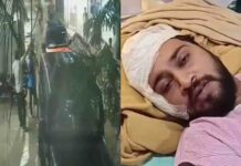 नाली विवाद को लेकर मारपीट, युवक को मोटरसाइकिल से कुचलने की कोशिश, पुलिस पर FIR न दर्ज करने का आरोप