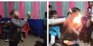 रील के लिए मौत से खेला, आग उगलने का स्टंट करते हुए बच्चे का चेहरा झुलसा